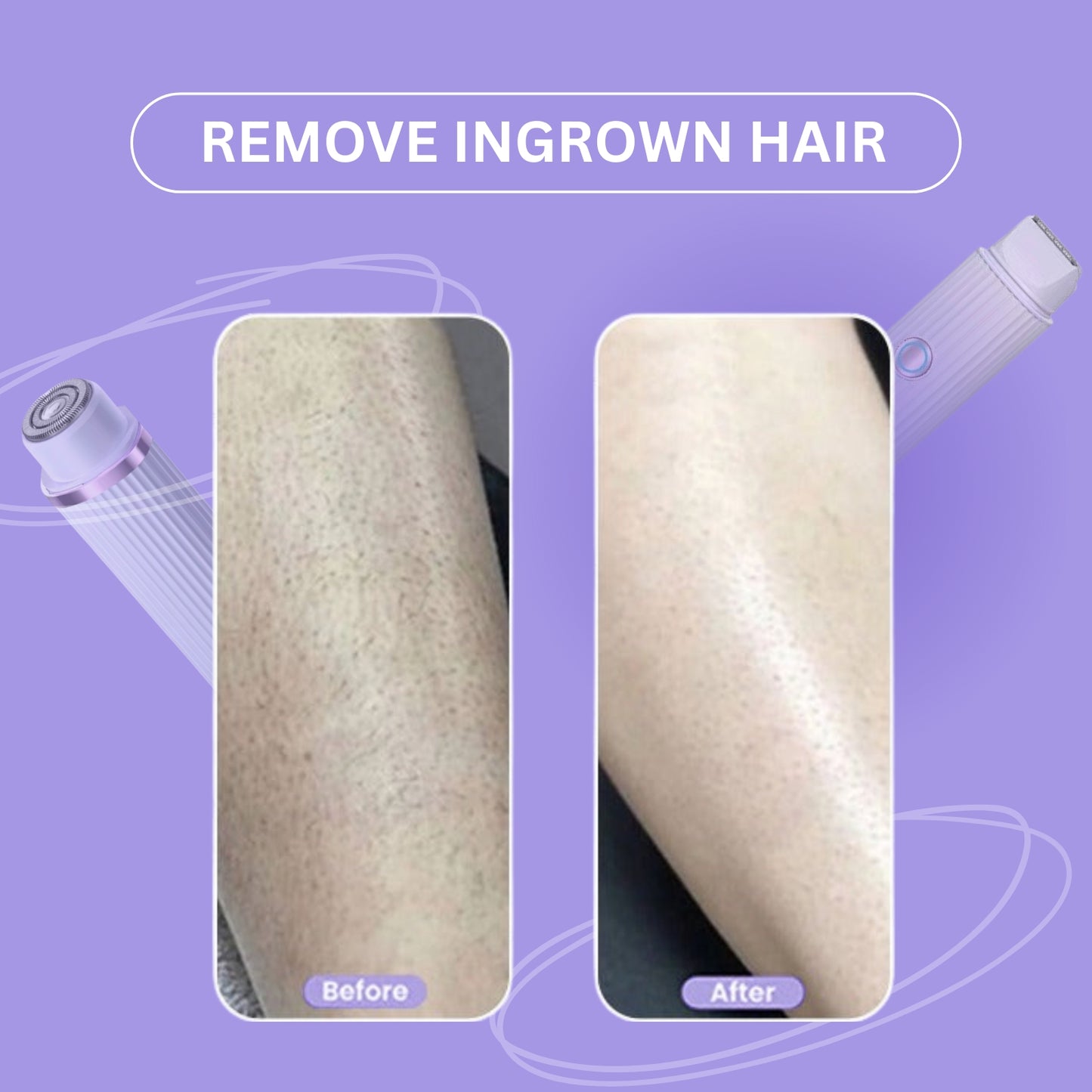 Women’s 2-in-1 Dual-Head Electric Shaver