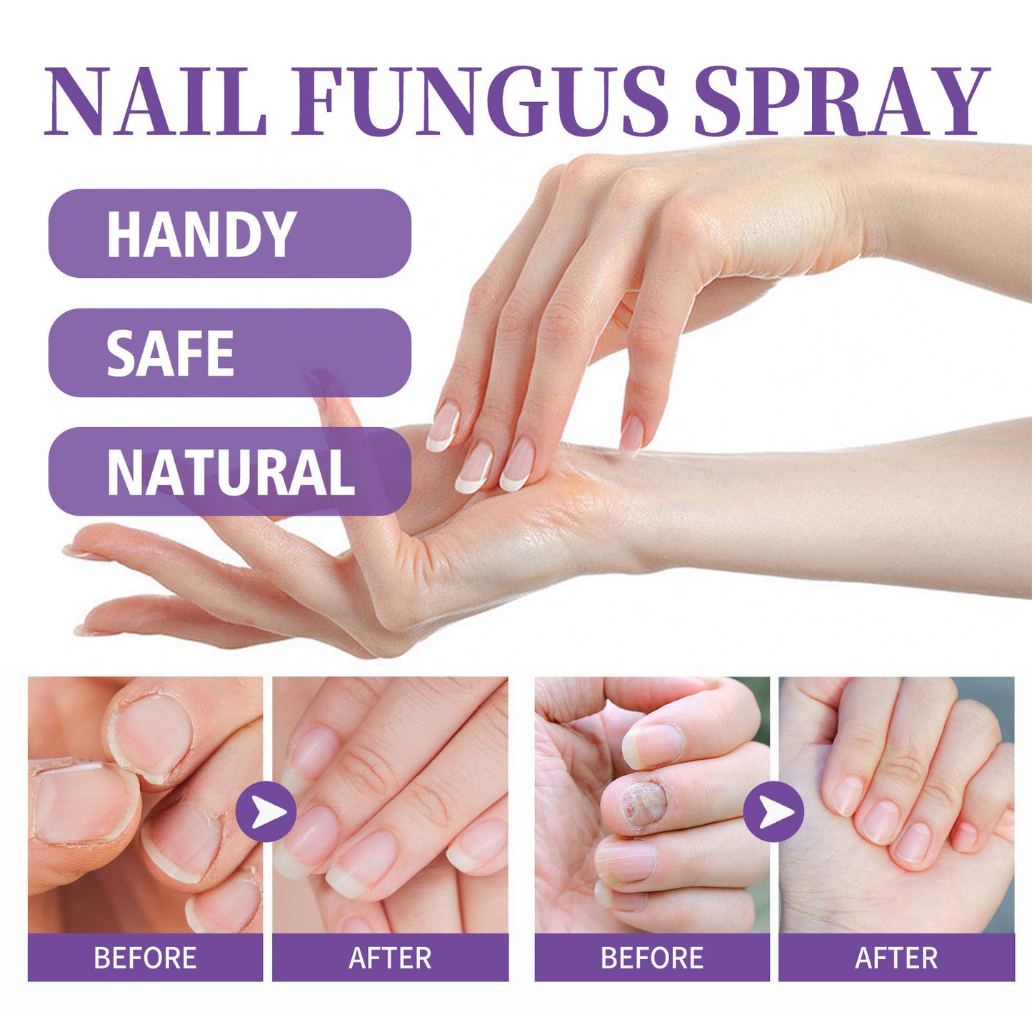 Jaysuin - Nail Fungus Spray
